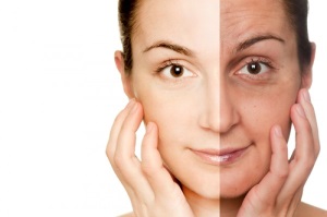 Виды лазерного омоложения кожи лица — хорошие стороны и последствия